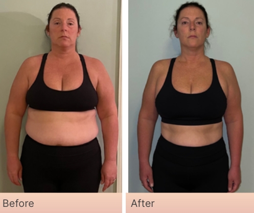 Before and After Real Result pictures of a person who has used the NeoraFit System - 5
